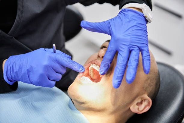 Best Emergency Dentist for Knocked-Out Tooth in Naples, UT