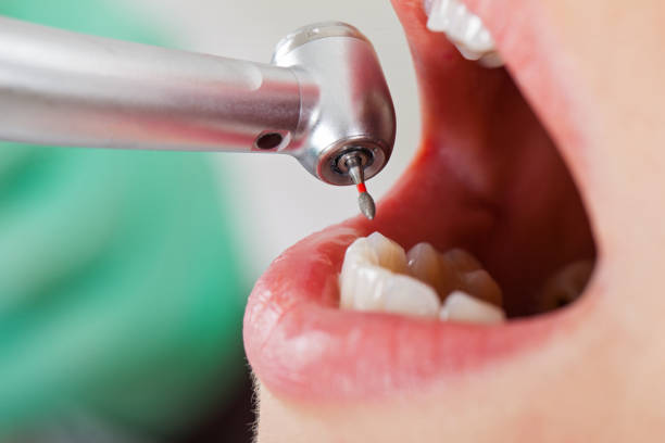 Best Orthodontic Emergency Dentist in Naples, UT